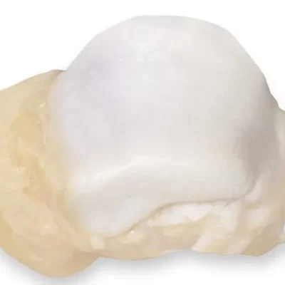 ASTRAGALO