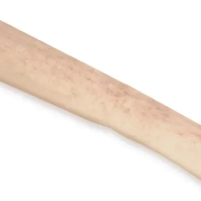 CILINDRO_DE_PERONE