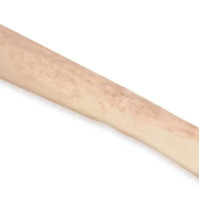 Fibular Shaft